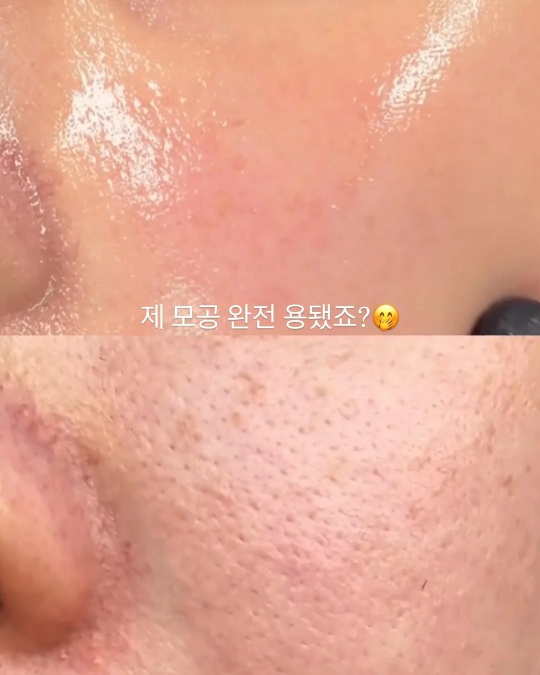 여름 코디 1