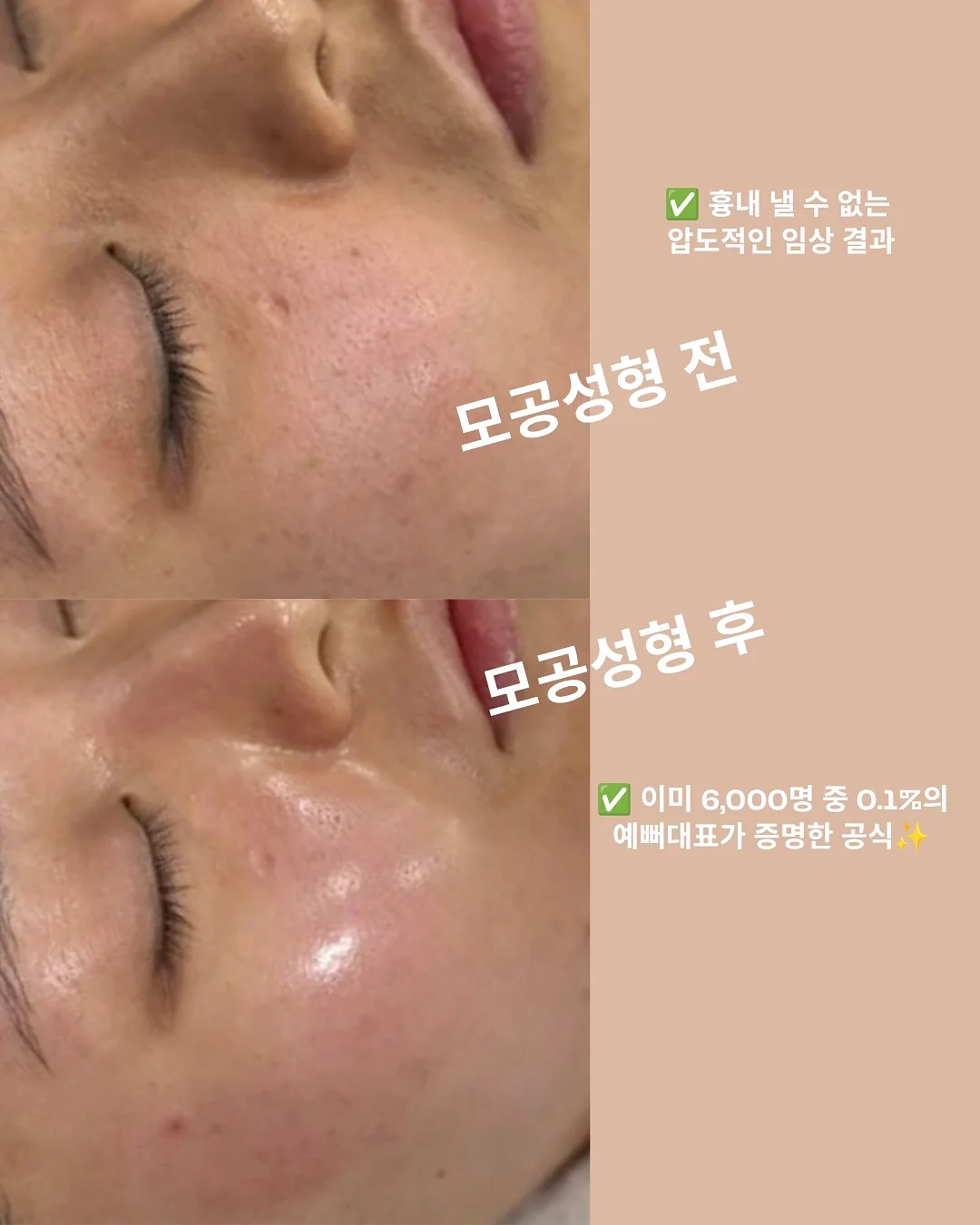 반려견 물티슈 3