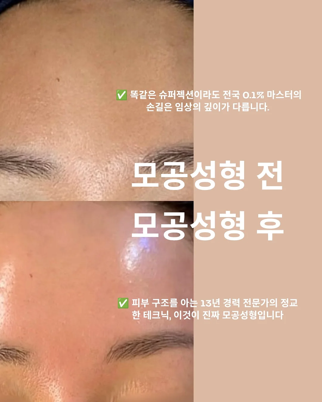 반려견 물티슈 5