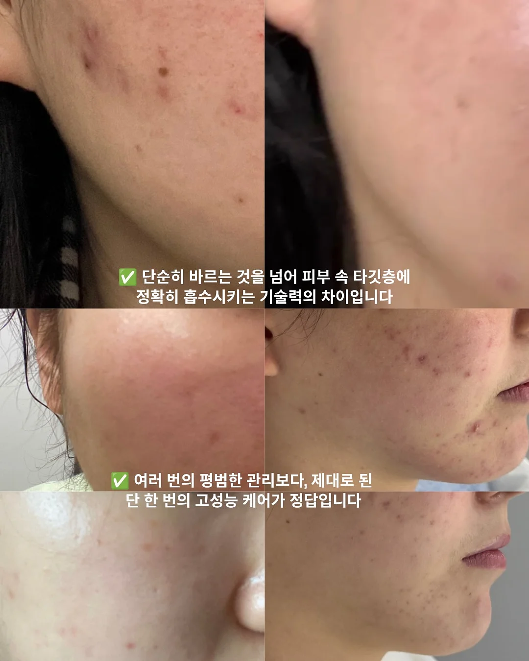 반려견 물티슈 7