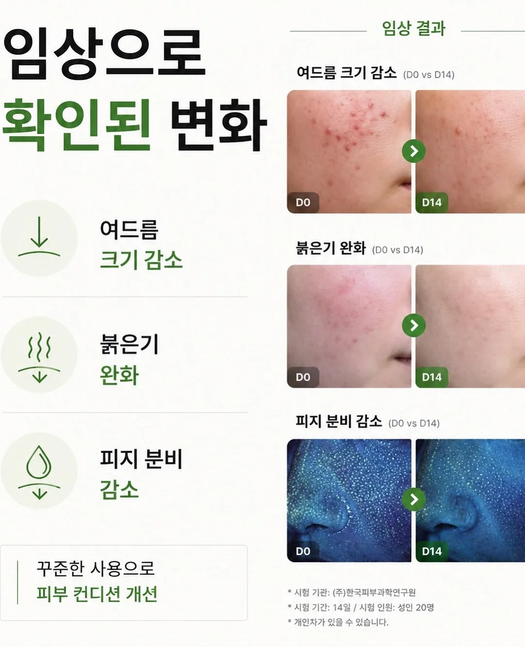 연세대 졸업스냅 8