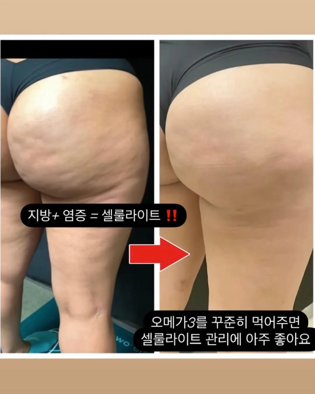 패디아트 6