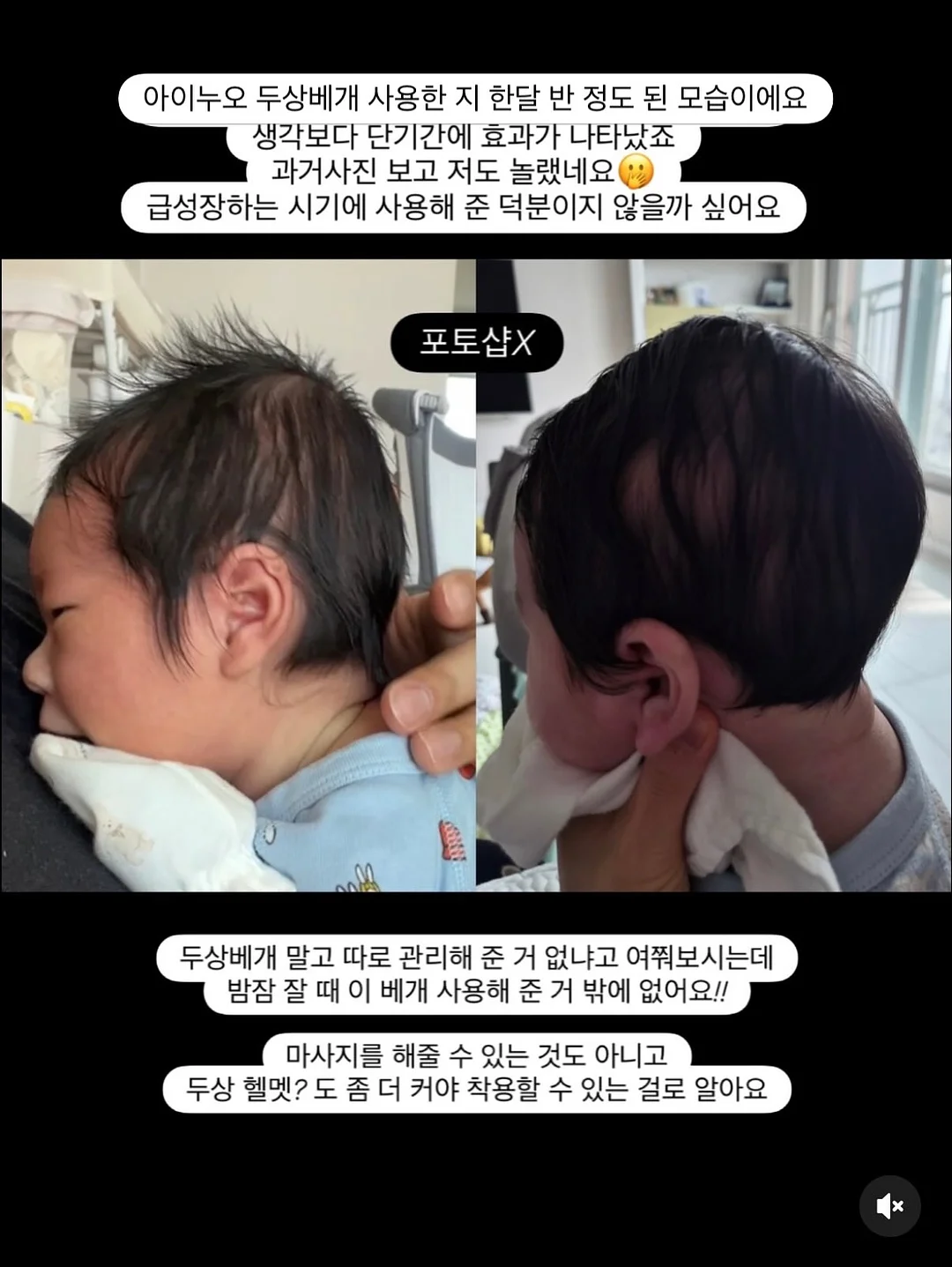스톤 디테일 튜브탑 스커트 세트 2
