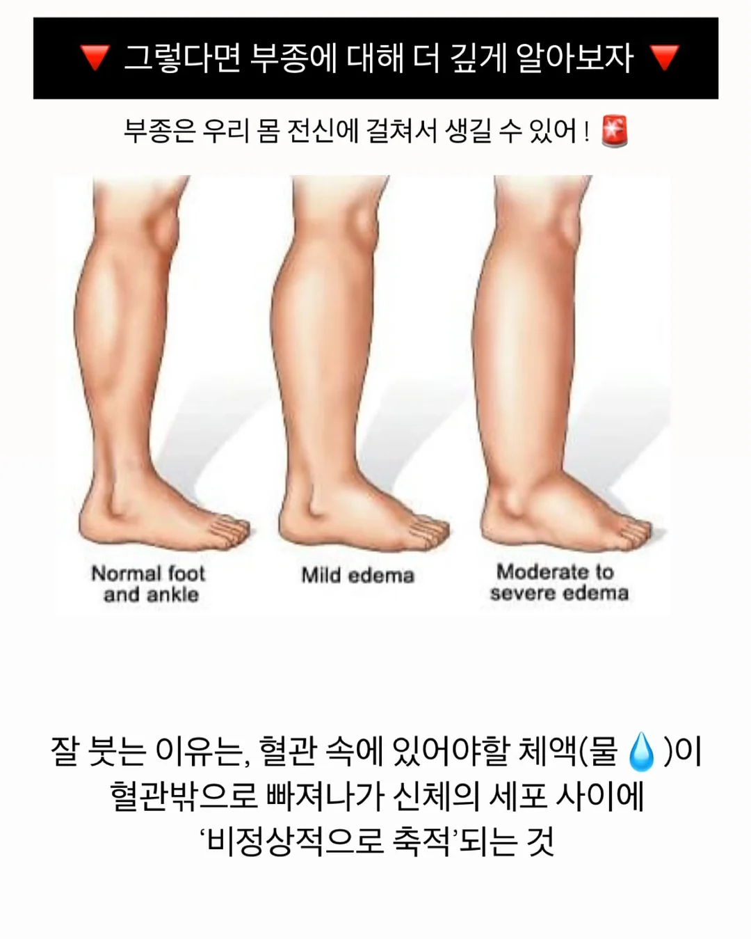 레이스 티셔츠 14