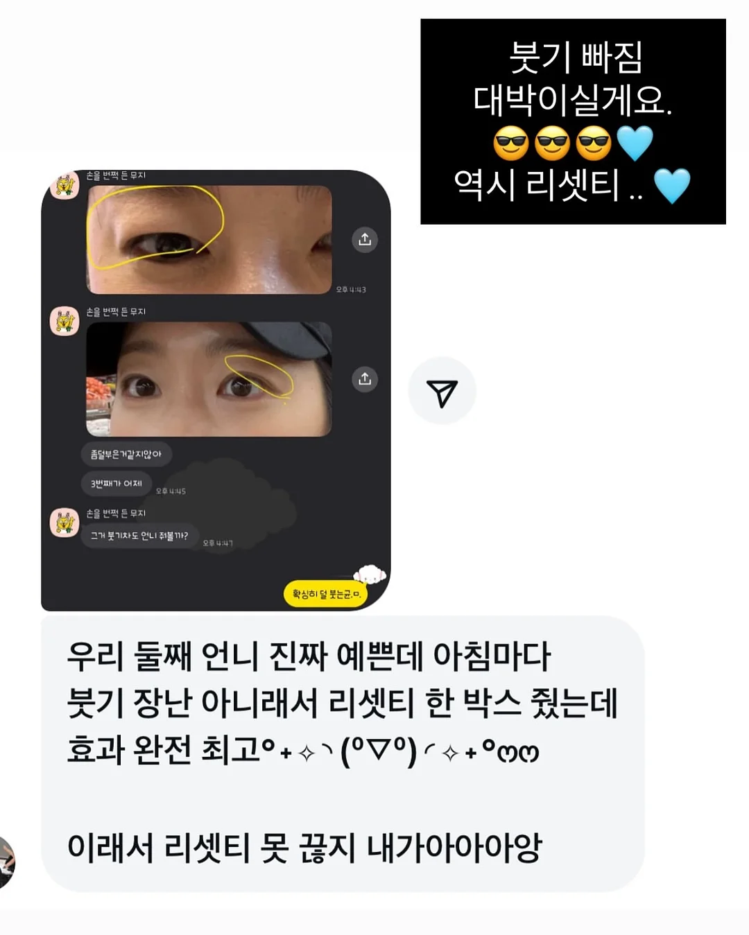 레이스 티셔츠 18