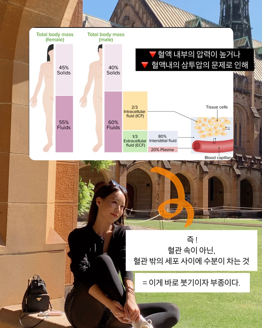레이스 티셔츠 7
