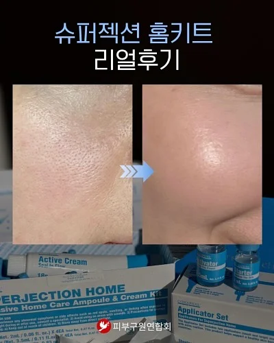 거름망 15