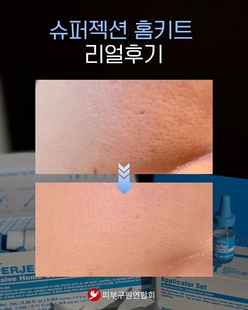 거름망 16