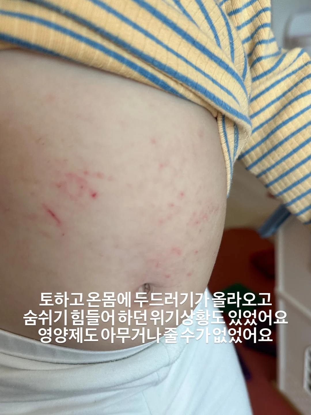 차량용 에어매트 3