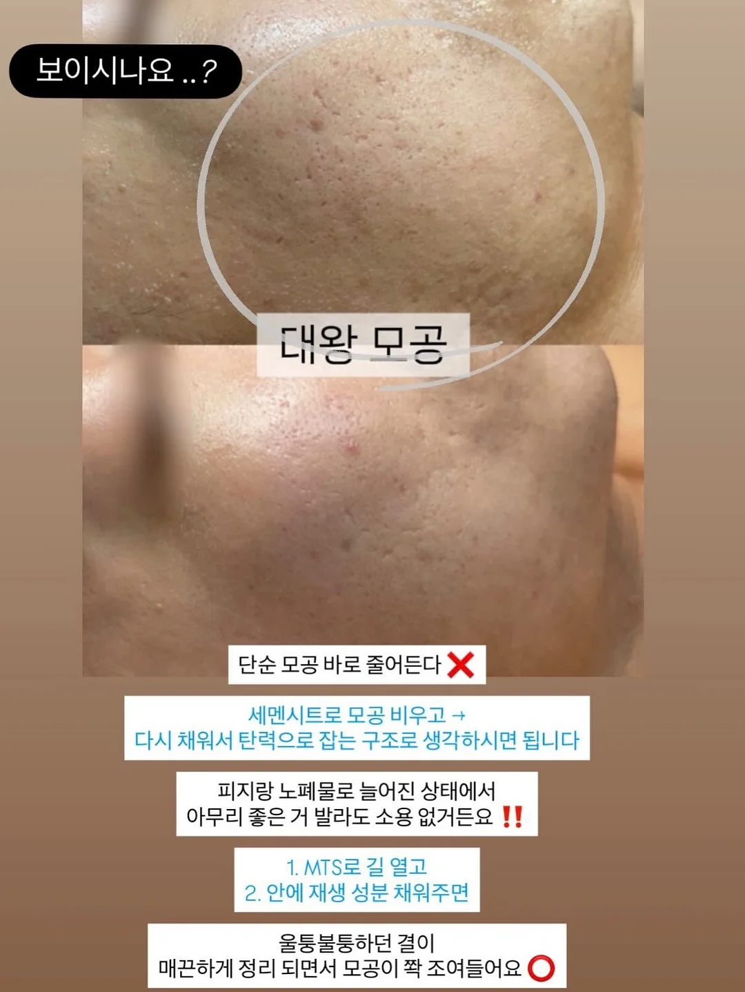 미니어 톤결크림 3
