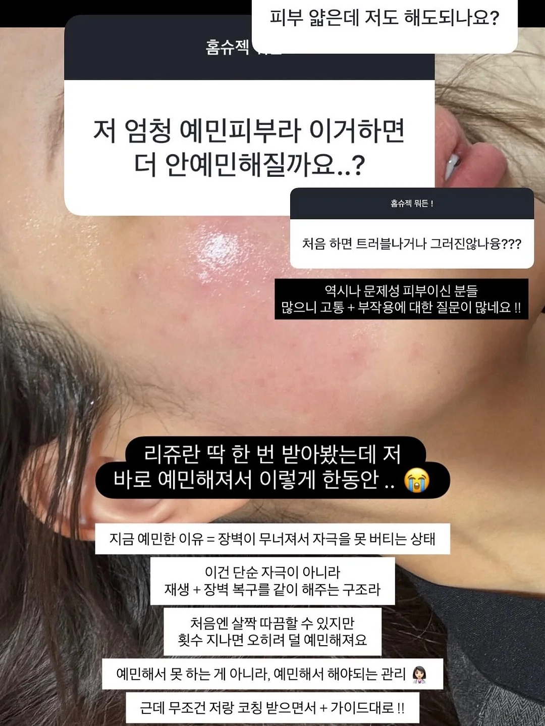 미니어 톤결크림 4