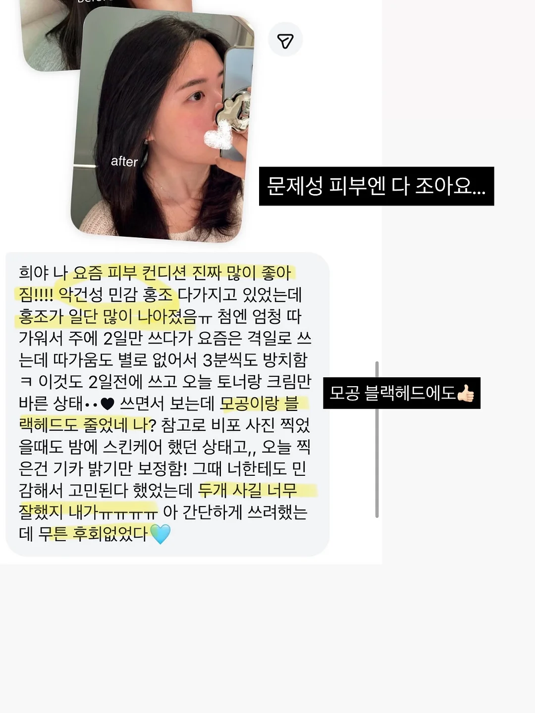 잔머리 고정 12