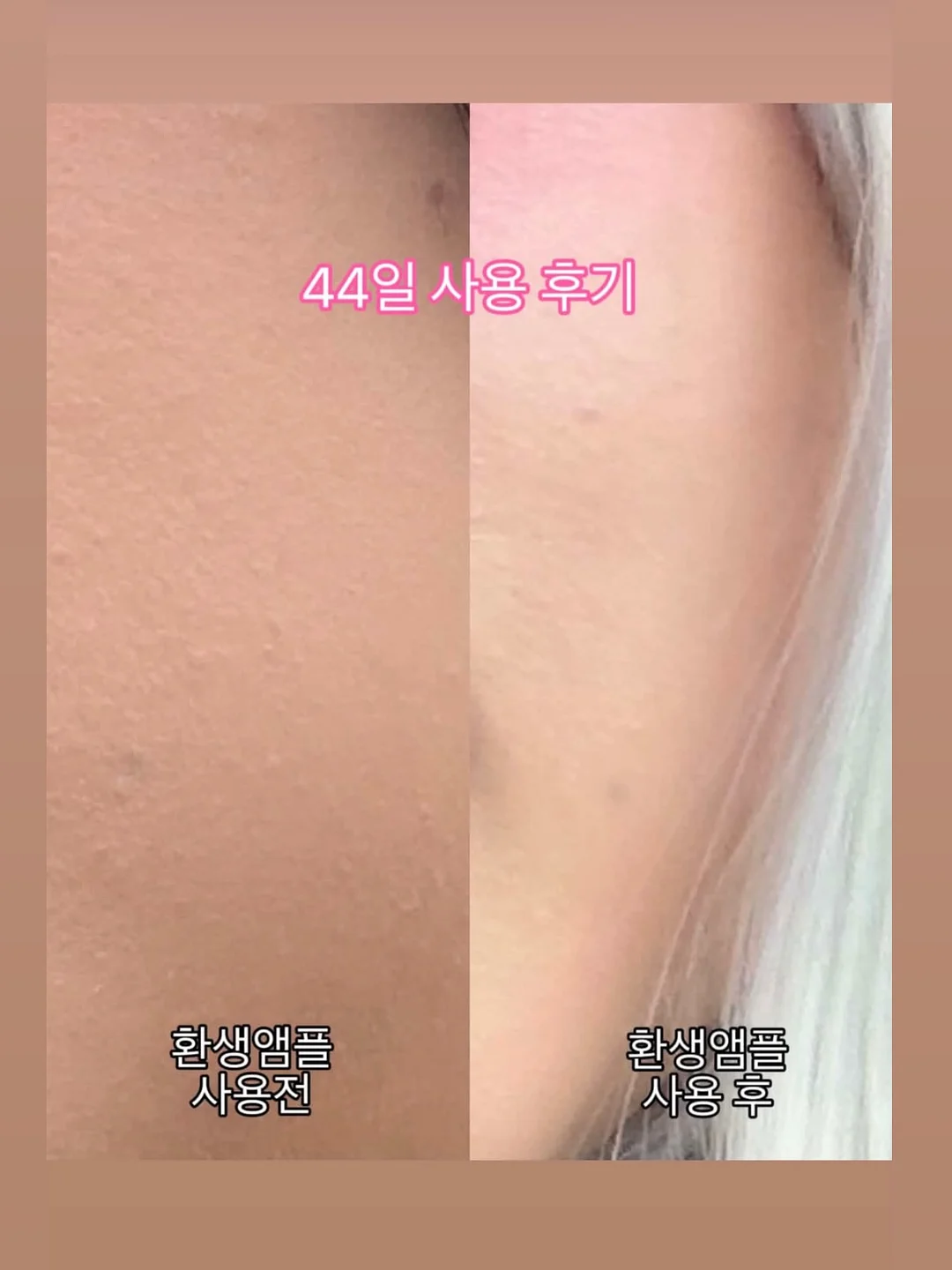 잔머리 고정 13