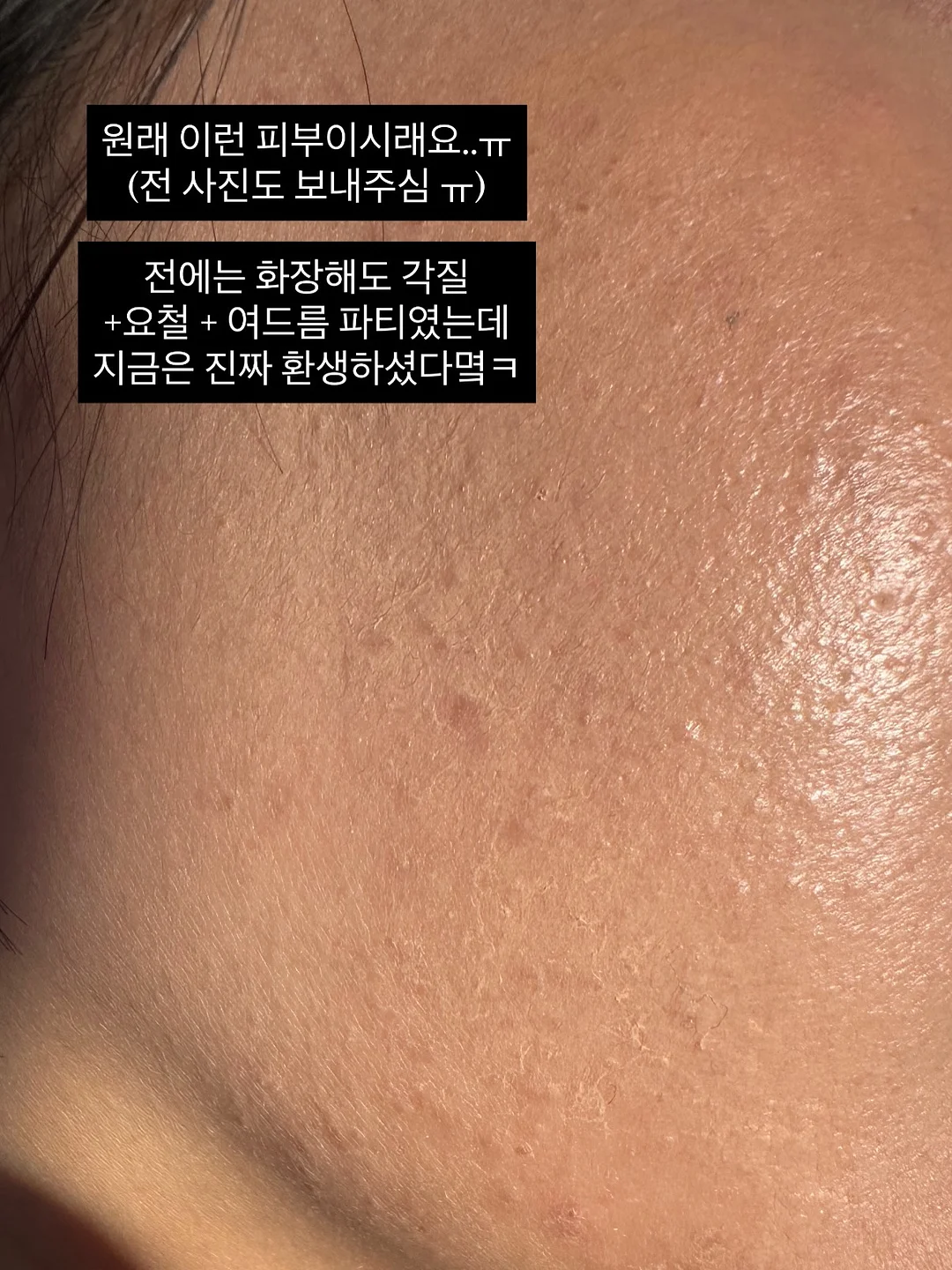 잔머리 고정 4