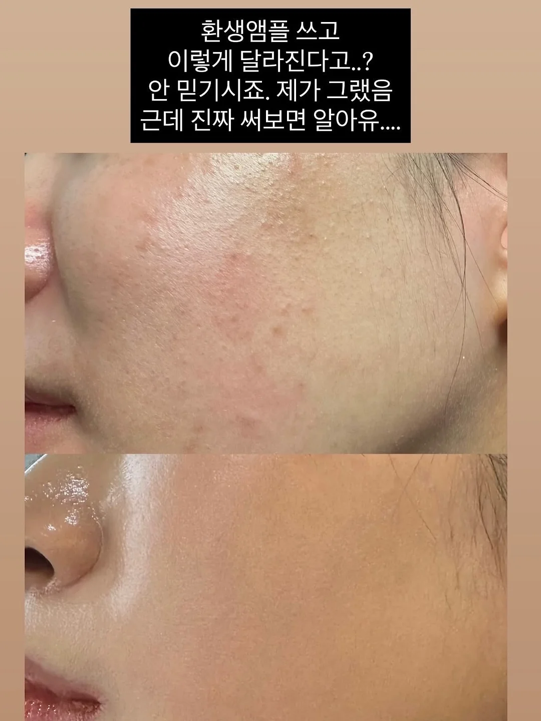 잔머리 고정 5