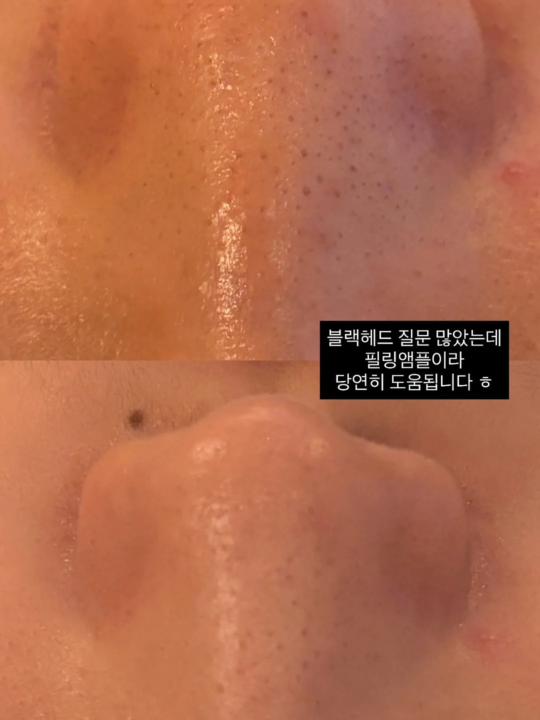 잔머리 고정 7
