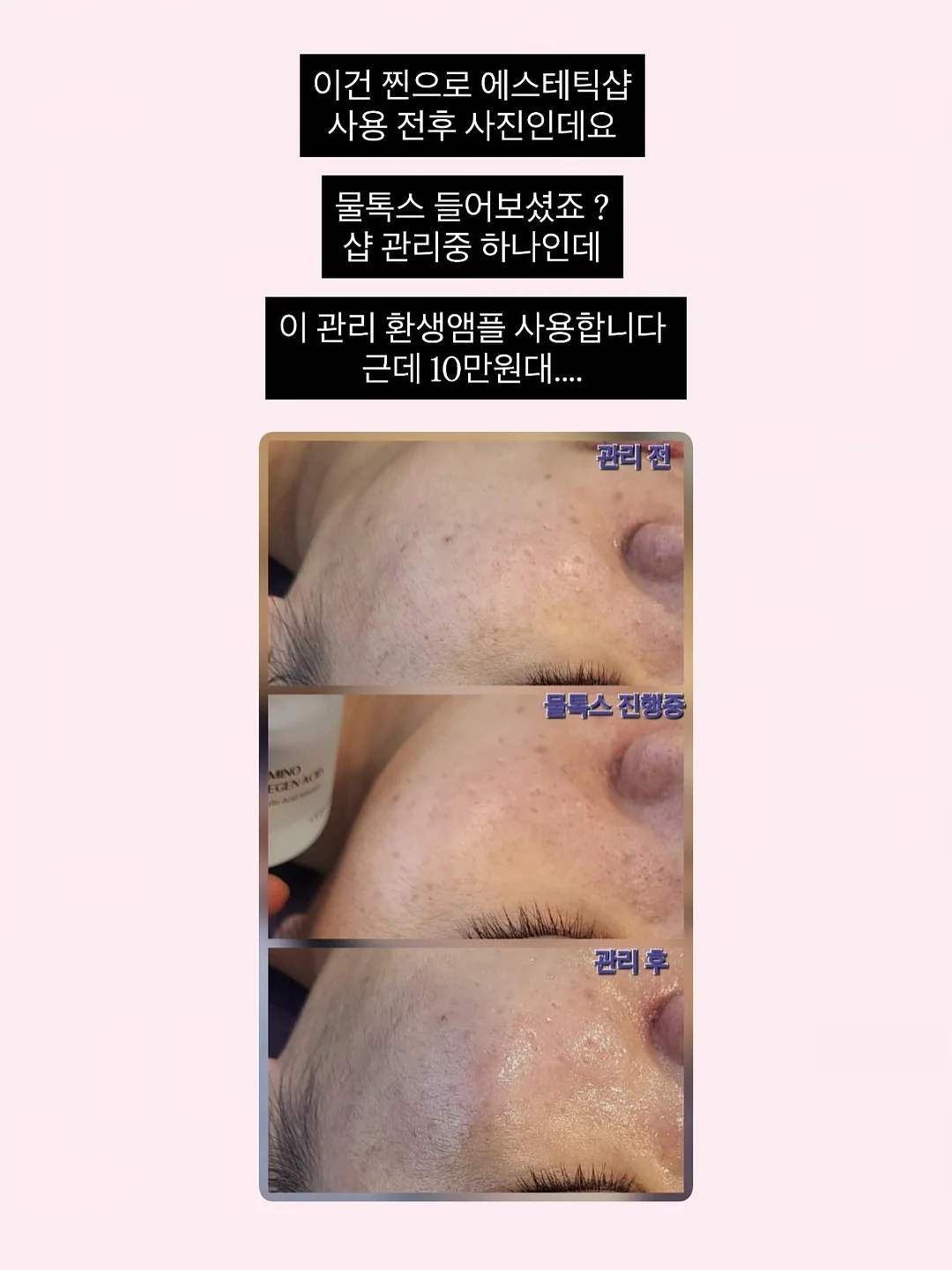 잔머리 고정 8