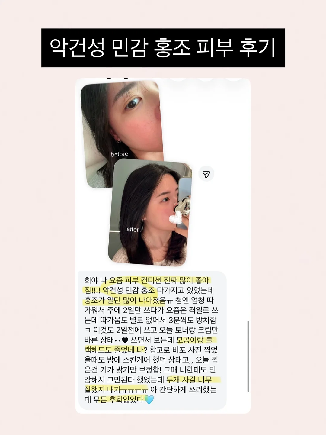 잔머리 고정 9