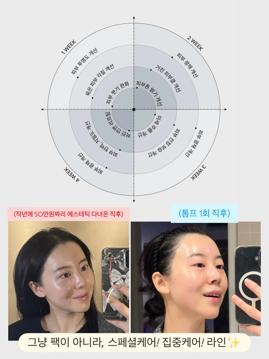 조준 멤버십 6