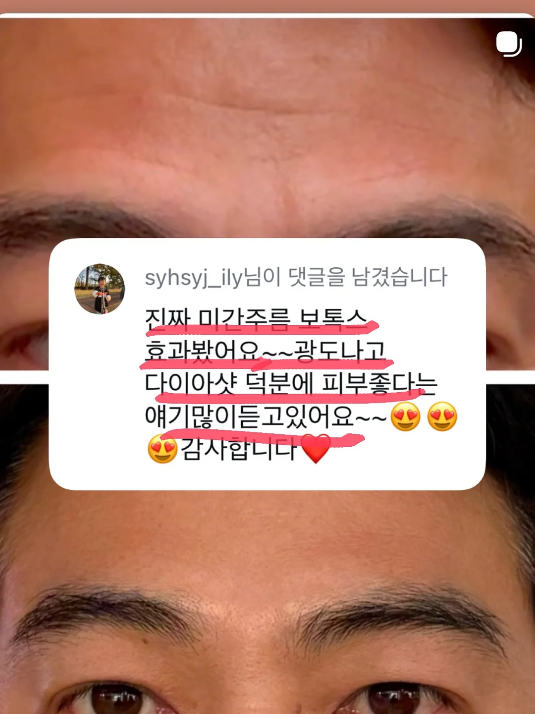 쫀득이 팬츠 여름 11
