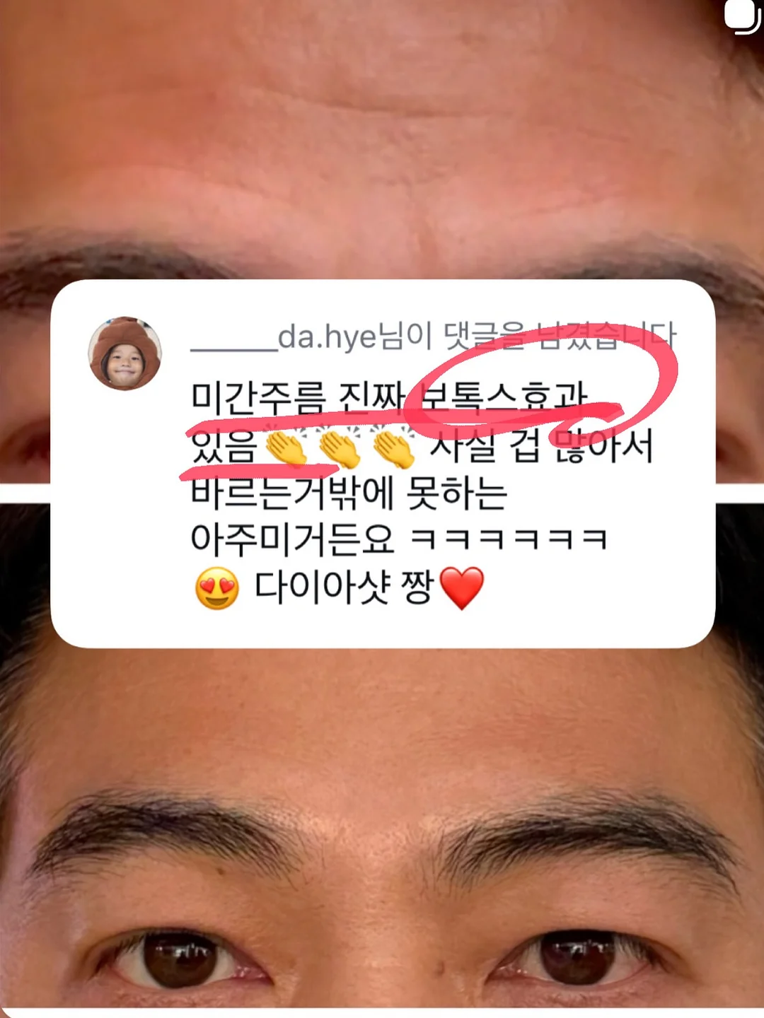 쫀득이 팬츠 여름 13