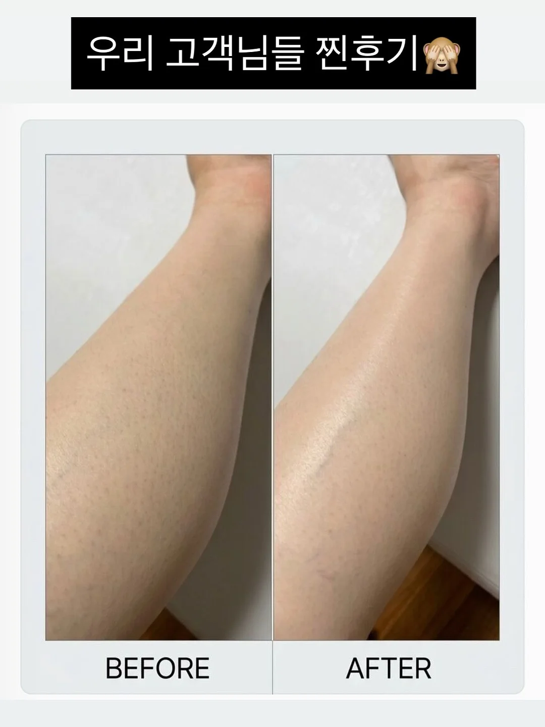 야채 쵸퍼 1