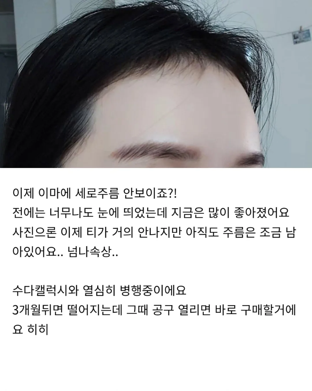 샴푸 브러쉬 4