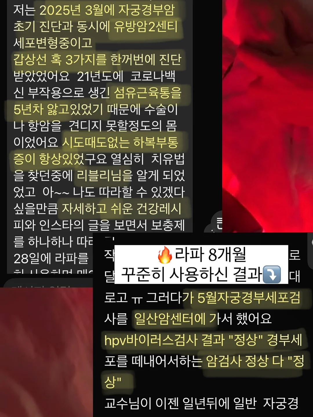 우산 10