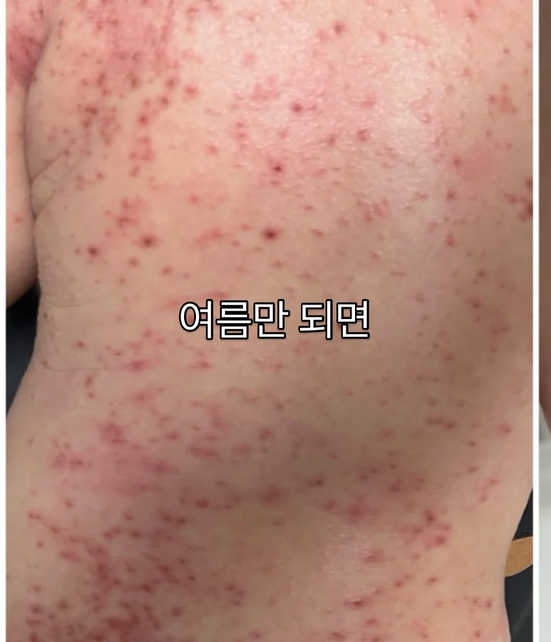 밀크티비니 1
