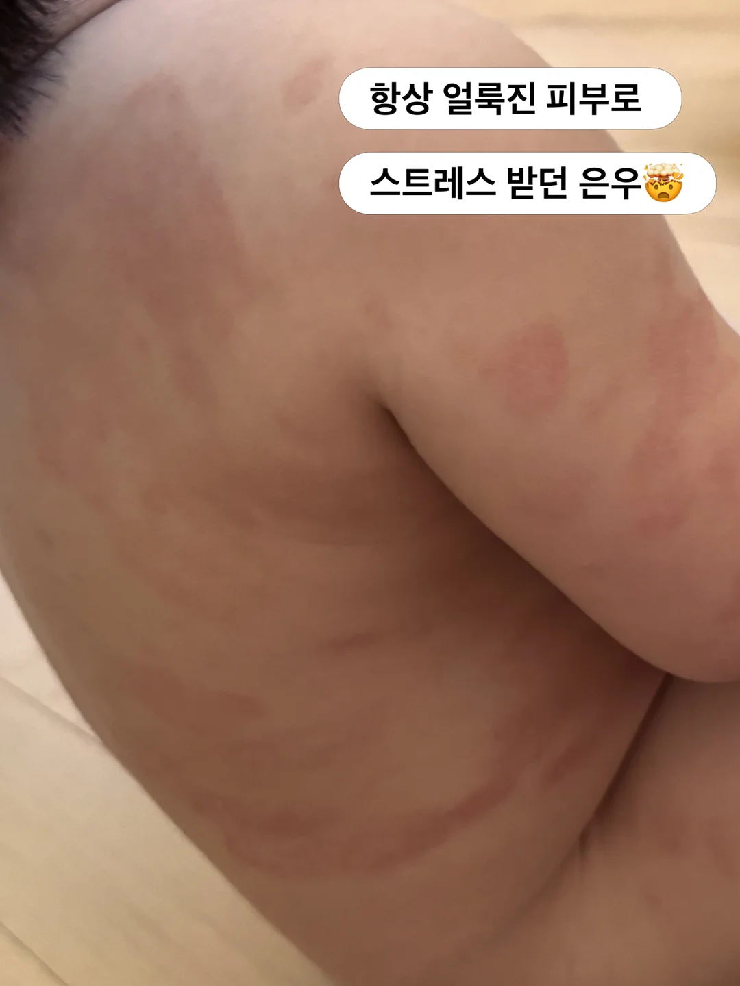 티파니꽃슈트 3