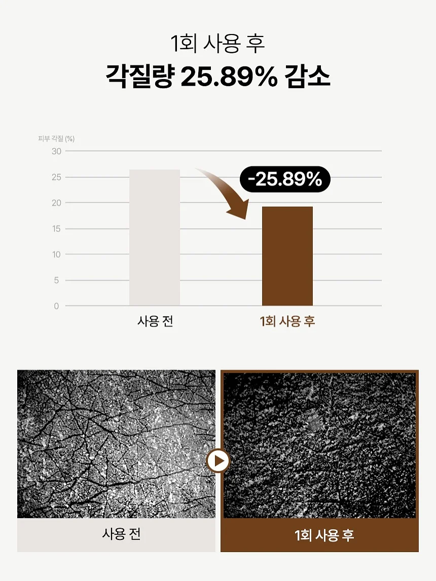 딸기라떼 스트라이프 pk 슬리브 12