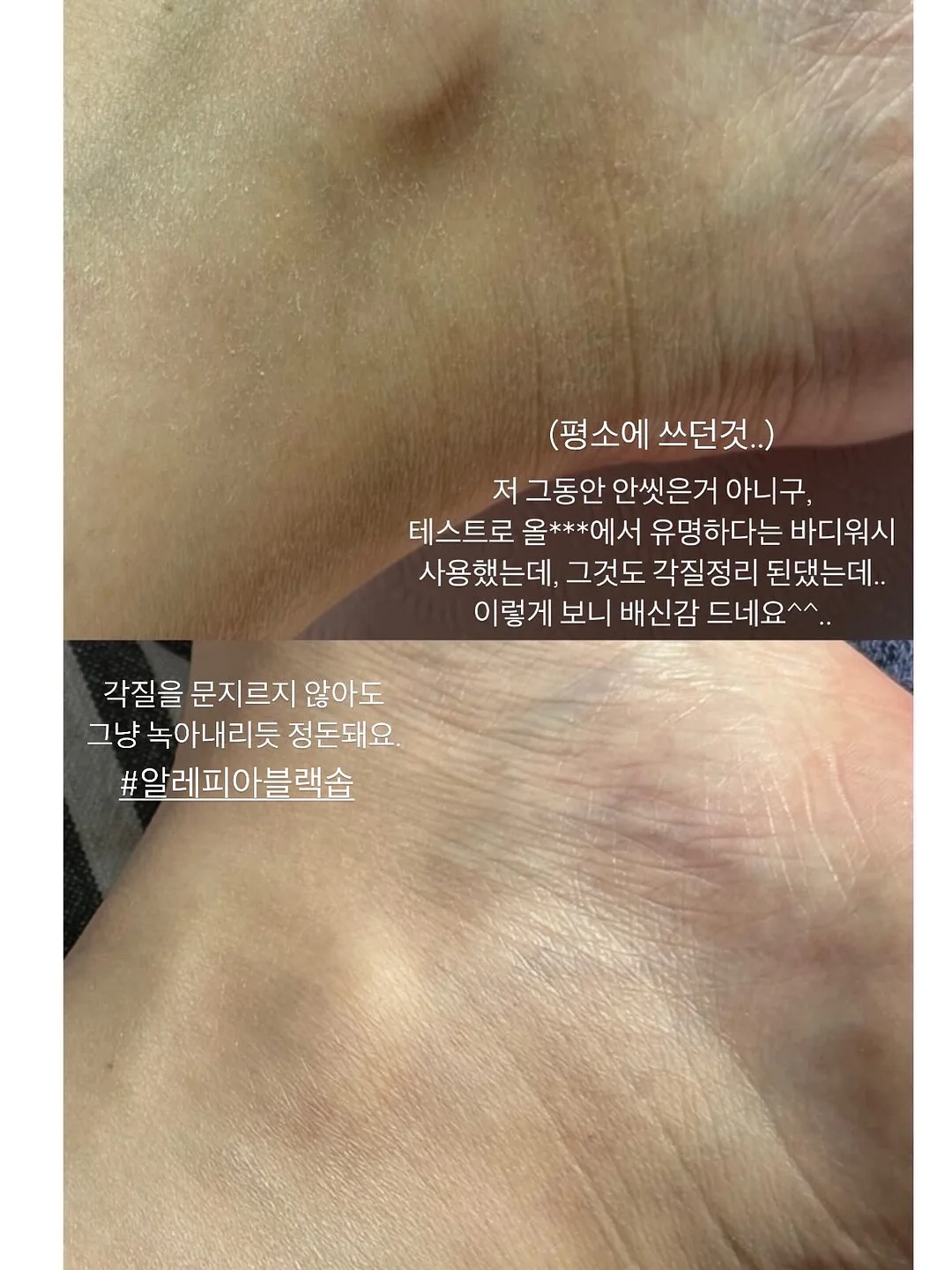 딸기라떼 스트라이프 pk 슬리브 2