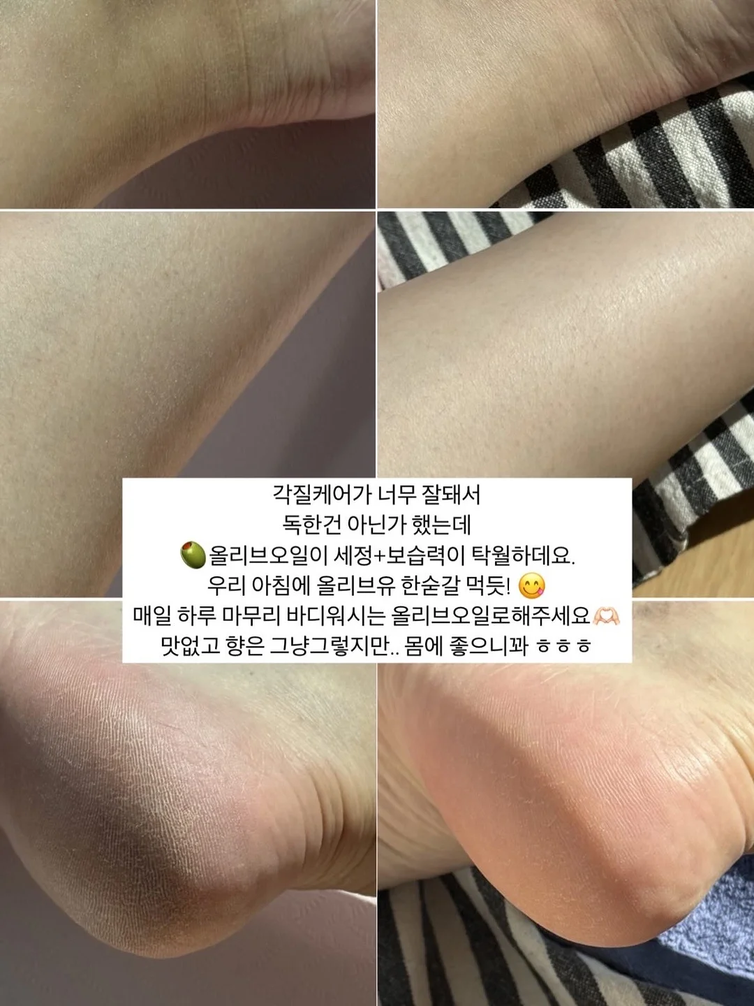 딸기라떼 스트라이프 pk 슬리브 7