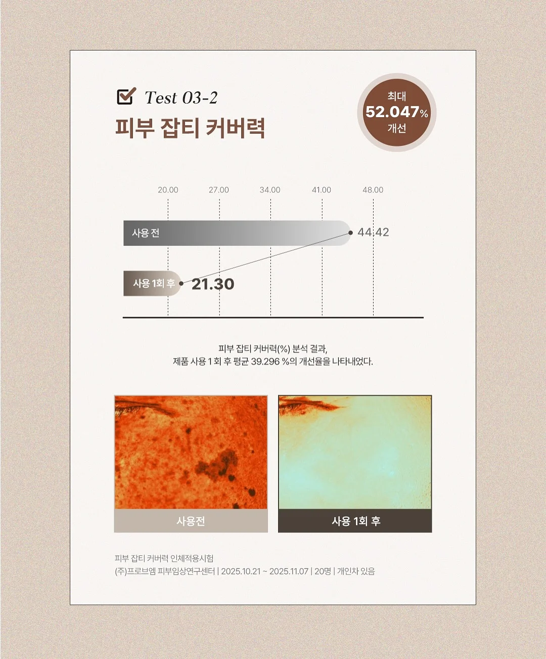 슈슈비 클립매트 11