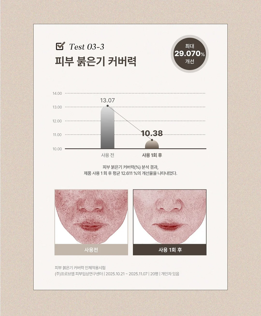 슈슈비 클립매트 10