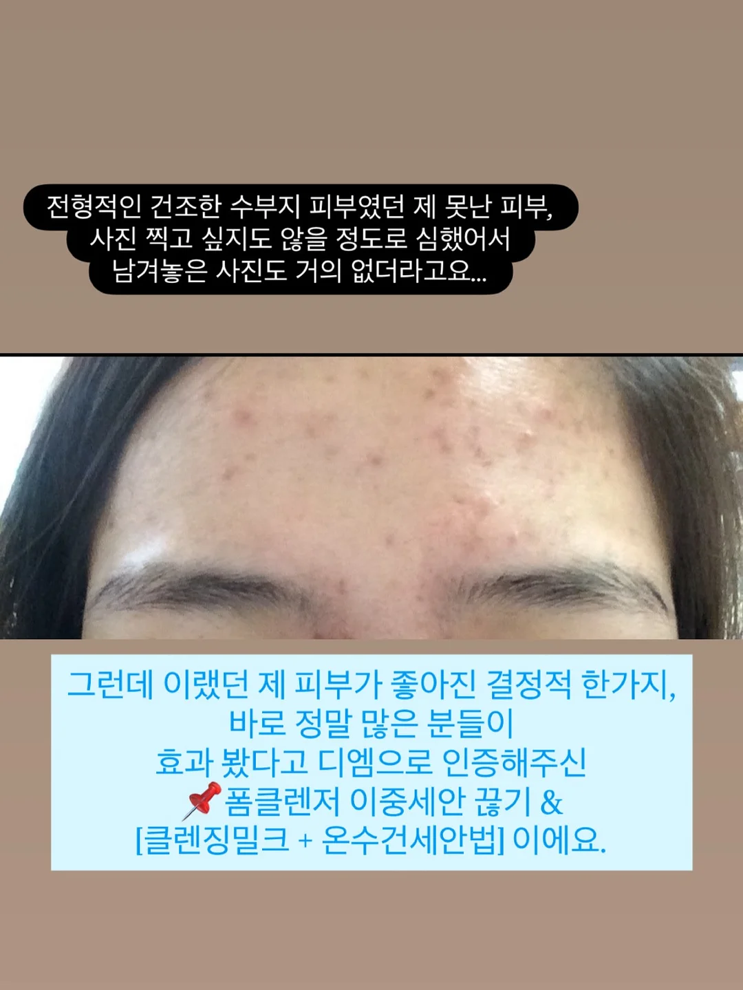 소예 여름 신상 2