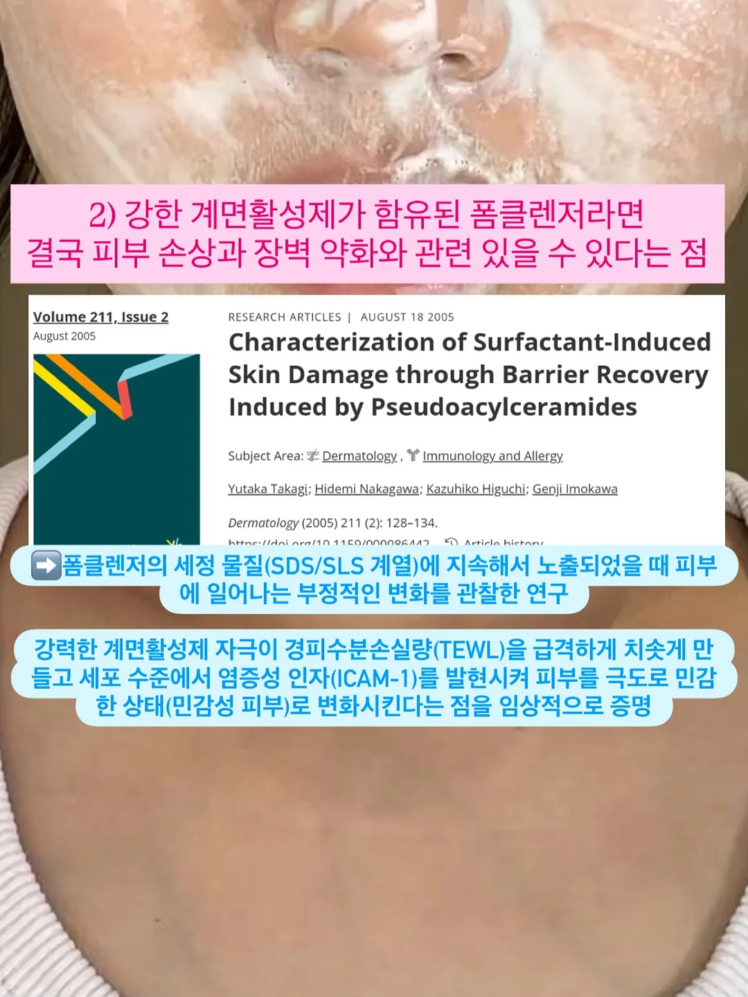 소예 여름 신상 4