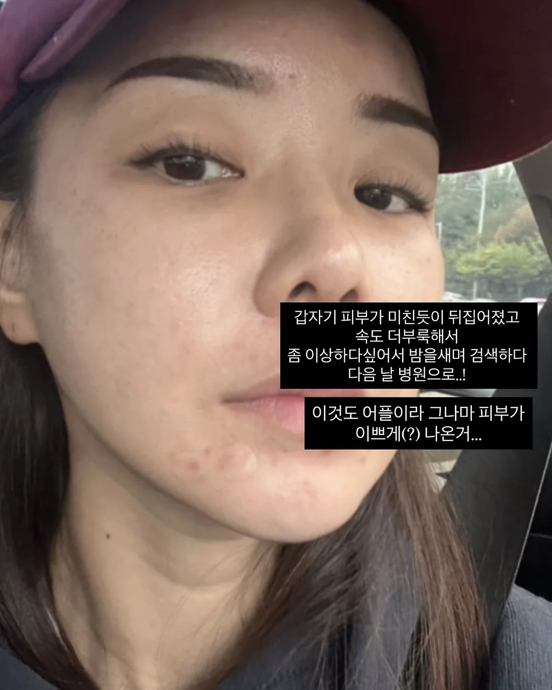 젤리백 5