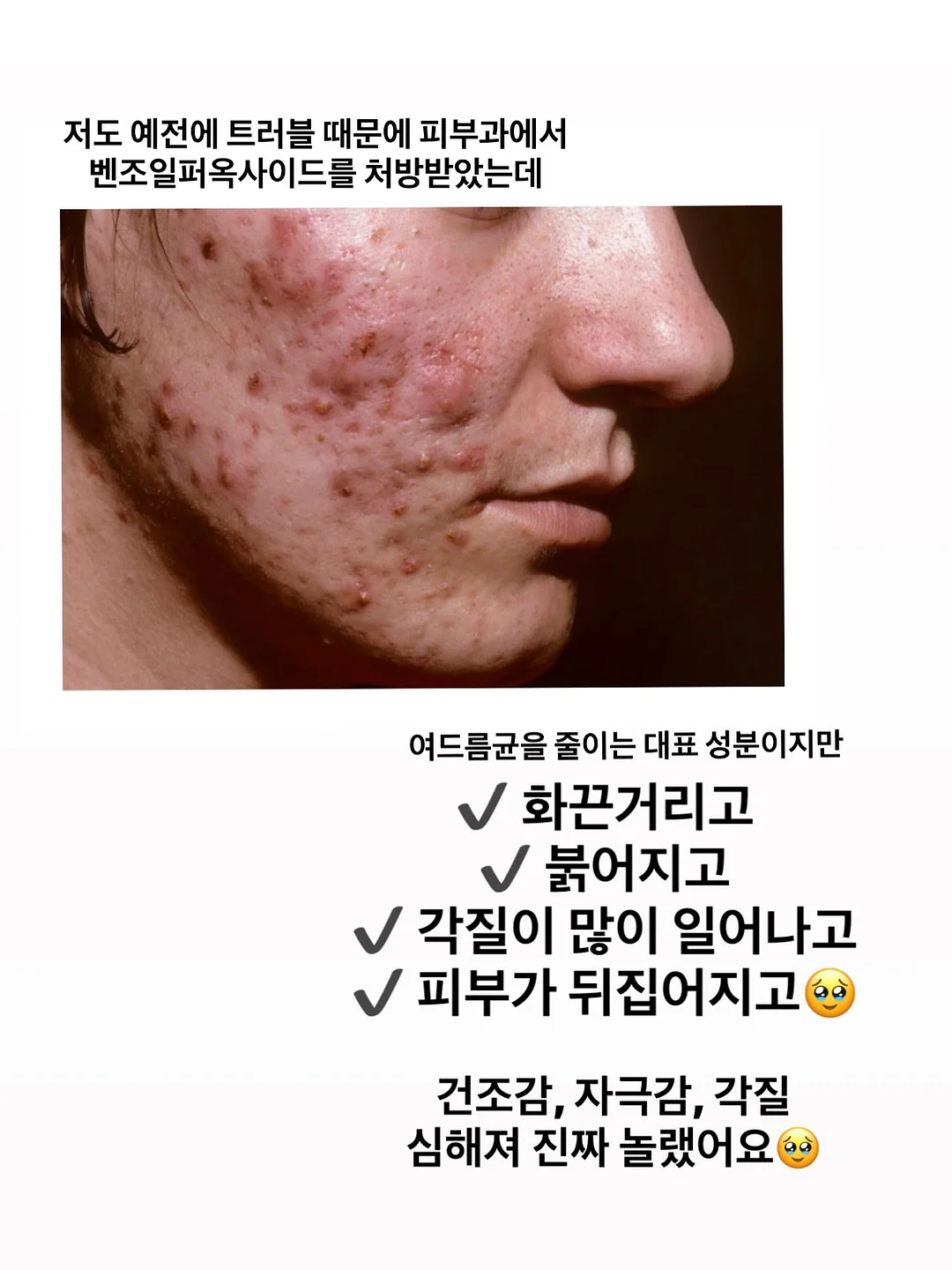 루리레이어드bl 4
