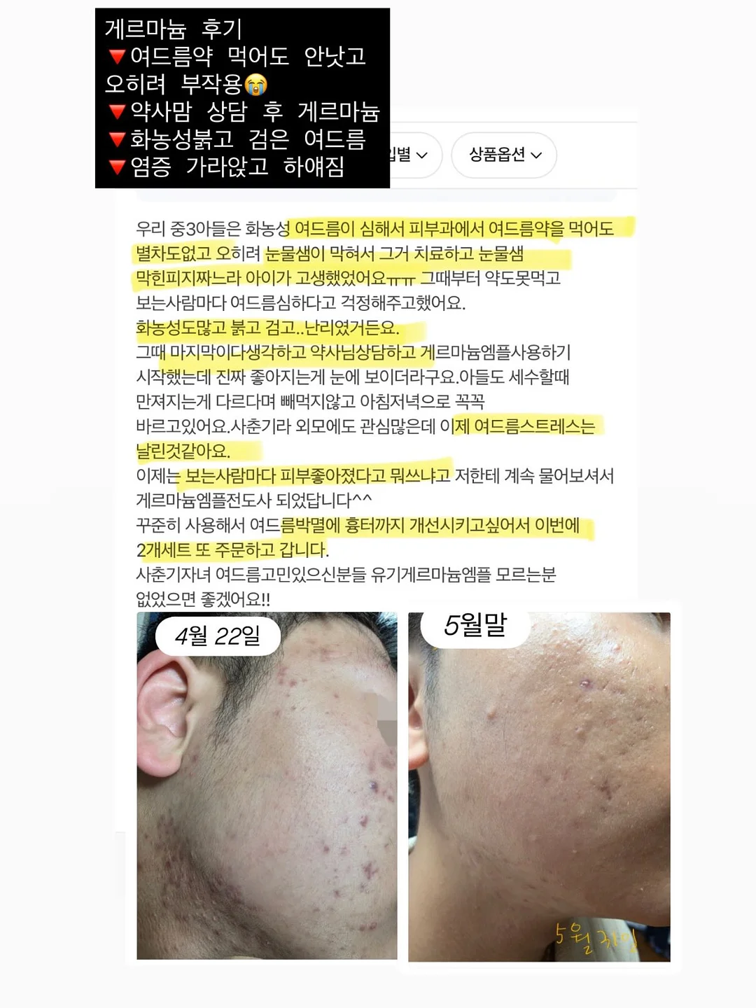 루리레이어드bl 10