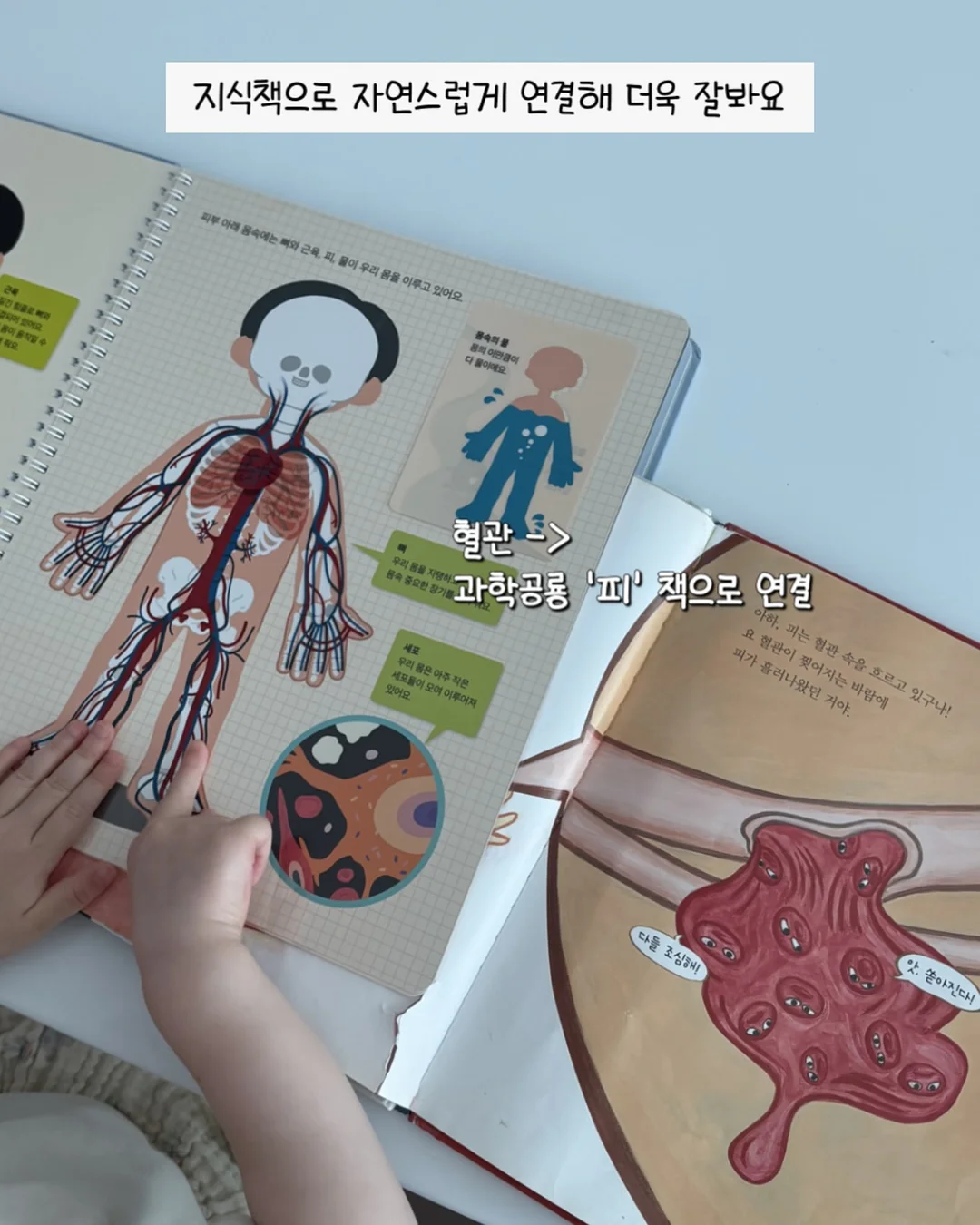 슈퍼젝션 홈키트 10