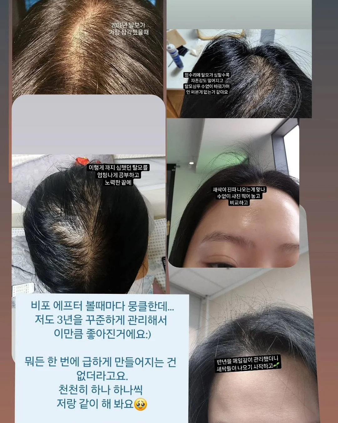 벤츠 W212 E63 AMG 7