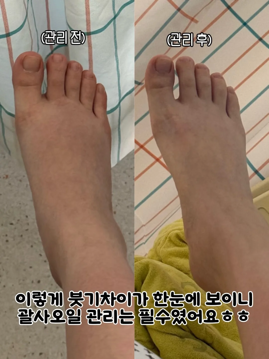 한 달 치 고단백 키성장 식단표 9