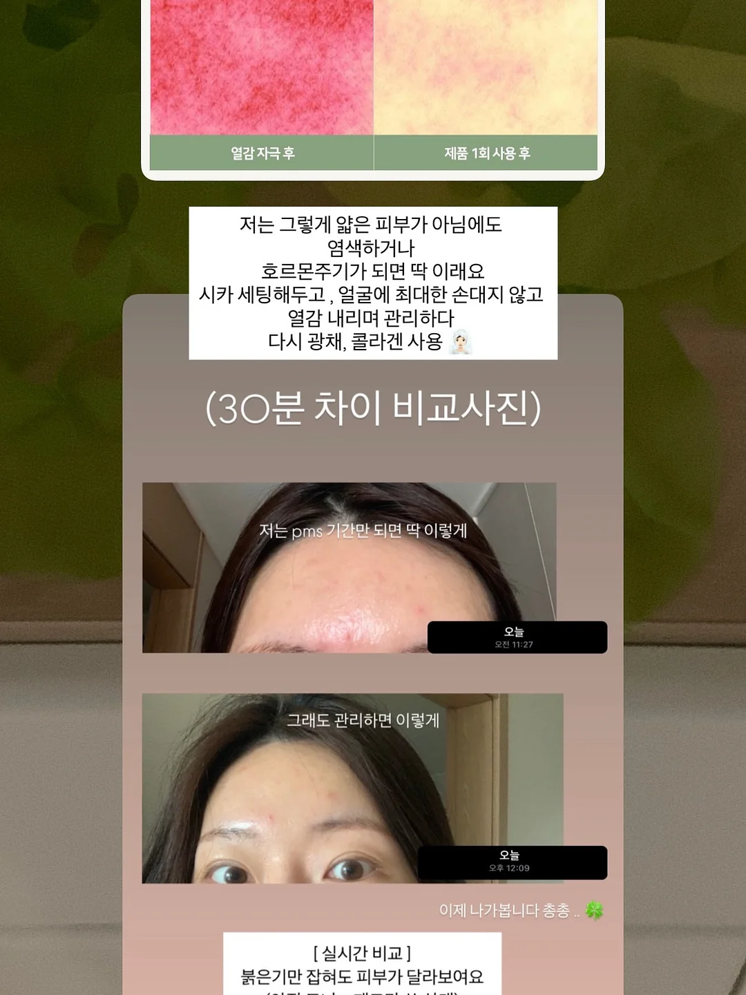 스트라이프 티셔츠 12