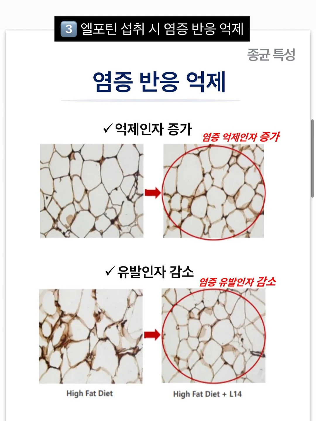 주름타파 레시피 SET 8