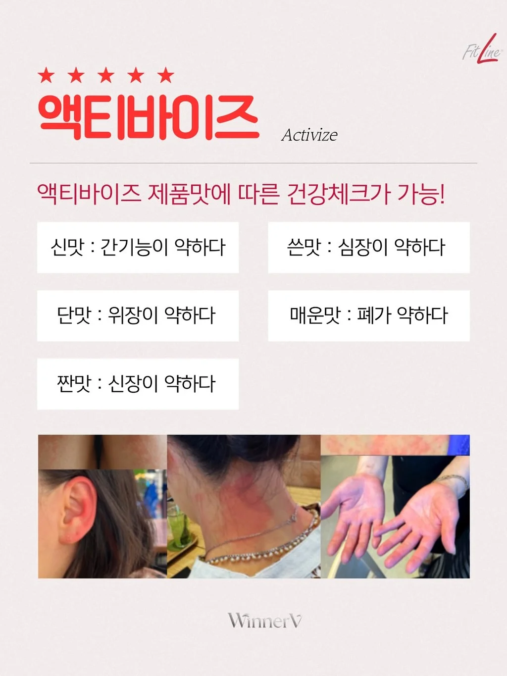 스크런치 10