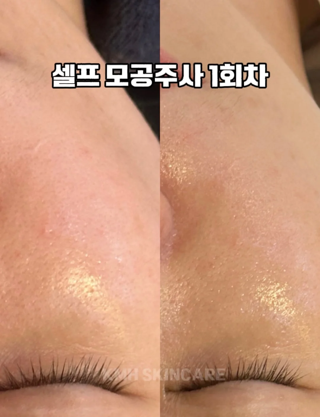 페퍼 여름 2