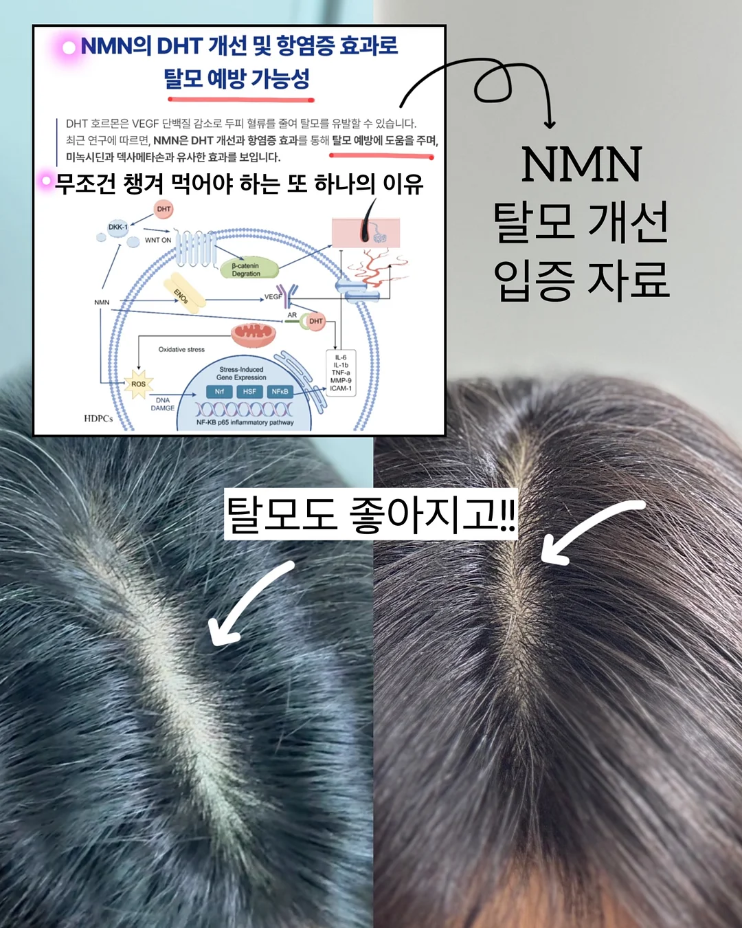 물 위 휴양지 해먹 6