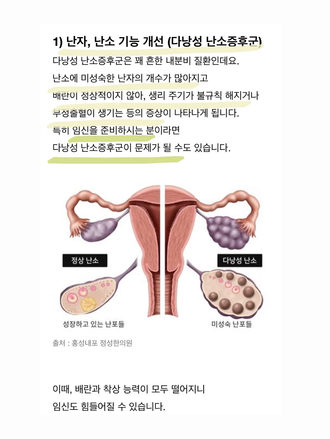 맞춤붙박이장 5