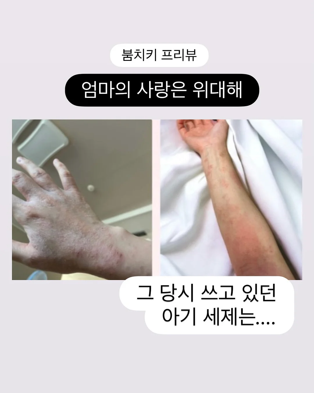 키에라 1